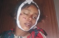 افسوسناک حادثہ، اٹھ سالہ بچی ٹریفک حادثہ میں جاں بحق
