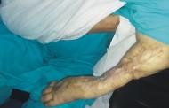 دس ماہ سے تنخواہ بند ہے، ٹھو ٹا ہوا ہاتھ دن بدن خراب ، امداد کی منتظر