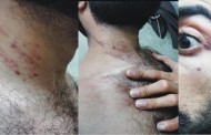 مینگورہ پولیس کی پولیس گردی ، نوجوان کو شدید تشدد کا نشانہ بناکر ہسپتال پہنچایا