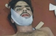 سوات میں ناجائز تعلقات، خاتون سمیت دو افراد کو زہر دیدیا گیا