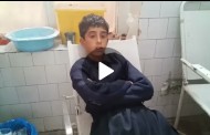 سوات، بااثر شخص نے دس سالہ بچے پر کتا چھوڑ دیا، بچہ مٹہ ہسپتال میں داخل