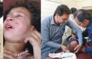 مٹہ میں ٹریفک کی دو مختلف واقعات اور لڑائی میں 22افراد زخمی زخمیوں میں ایک سکول کا بچہ اور رکشہ ڈرائیور کو سیدو شریف ہسپتال منتقل