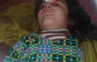 مدین میں باولے کتوں کا راج ,سرکاری ویکسین نایاب۔عوام پریشان