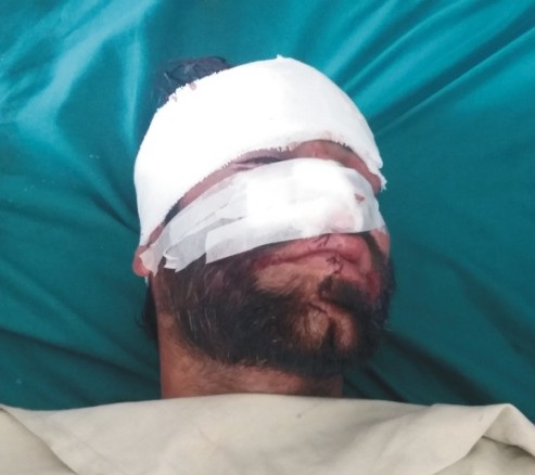 Accident In Matta one Injured