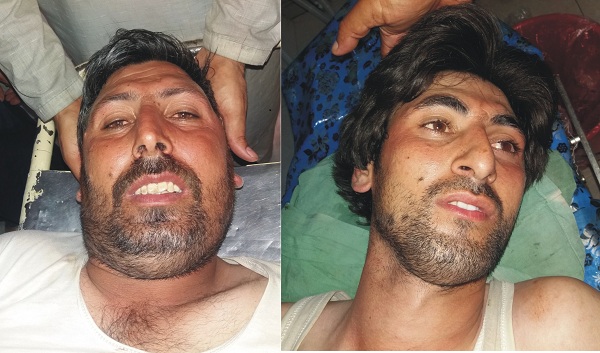 Three person injured in matta swat