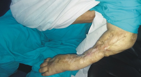 دس ماہ سے تنخواہ بند ہے، ٹھو ٹا ہوا ہاتھ دن بدن خراب ، امداد کی منتظر