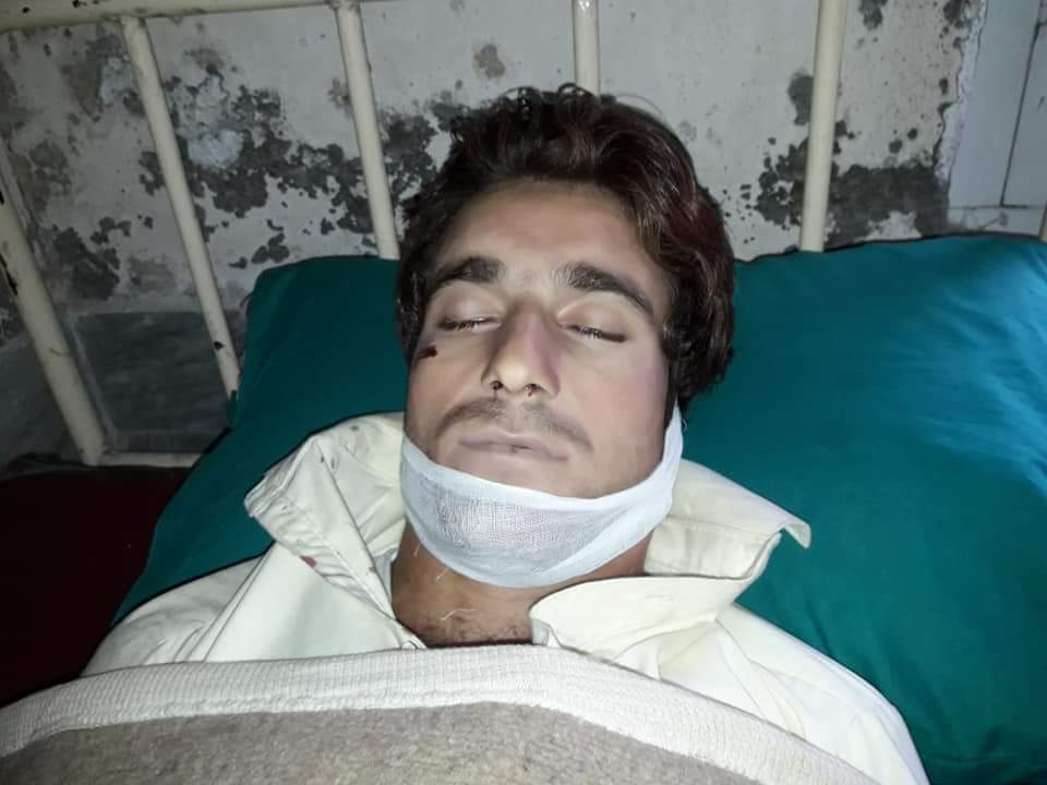 سوات۔ مختلف حادثات میں دو نوجوان۔جانبحق تین زخمی