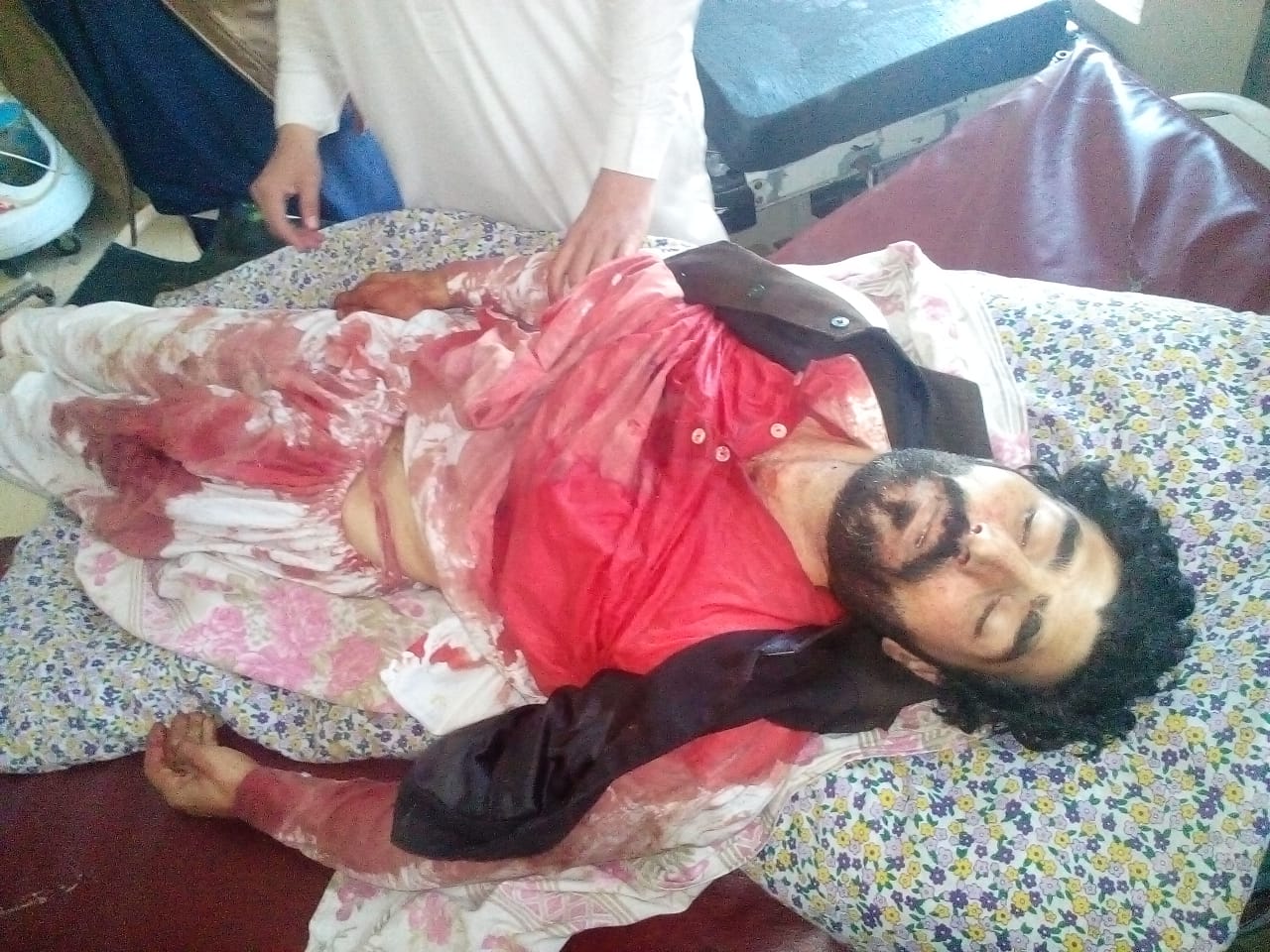 منگلور میں۔فائرنگ ایک شخص جانبحق ایک زخمی