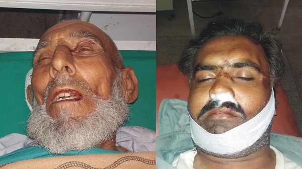 شکردرہ میں ٹریفک حادثہ بیٹا جاں بحق باپ زخمی