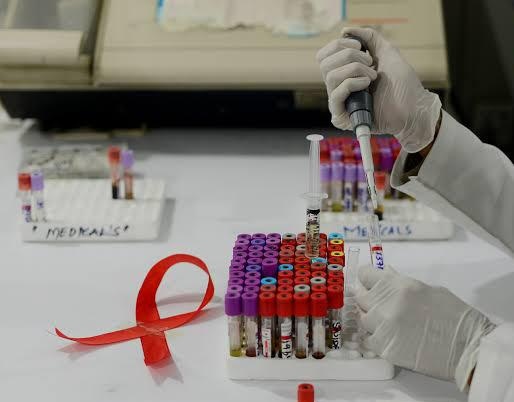 ایچ ائی وی وائرس ، 35 فیصد لوگوں کو استعمال شدہ سرنج سے مرض لاحق ، تہلکہ خیز انکشاف
