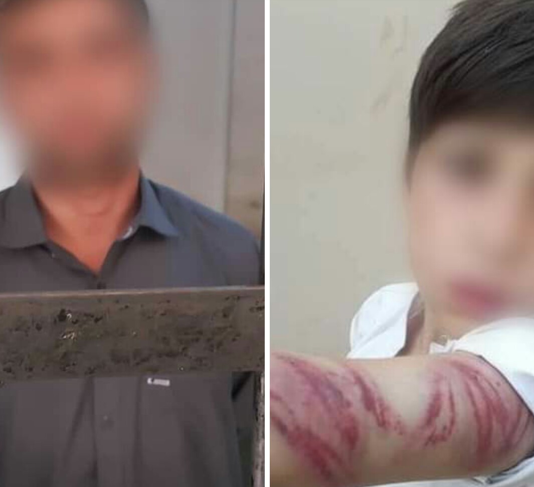 سوات، دس سالہ بچے پر تشددکرنے والا ملزم گرفتار