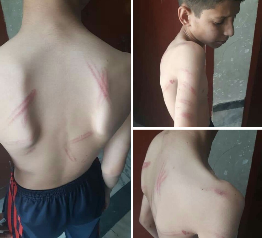 سوات،بچوں پرتشدد کرنیوالے سکول پرنسپل کیخلاف ایف ائی اردرج