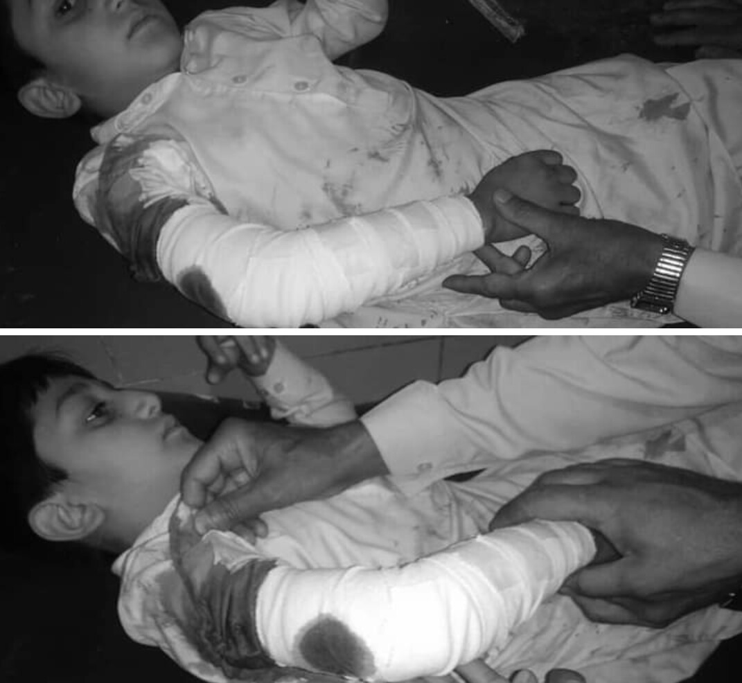 سوات، ہوائی فائرنگ ، اندھی گولی اٹھ سالہ بچے کو لگ گئی