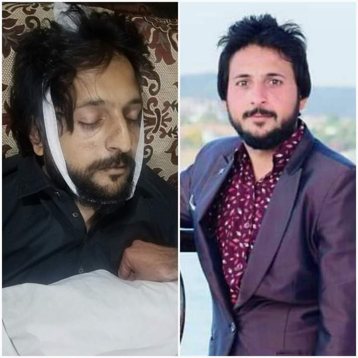 سوات، نجی ہسپتال میں اپریشن کے بعد نوجوان جاں بحق