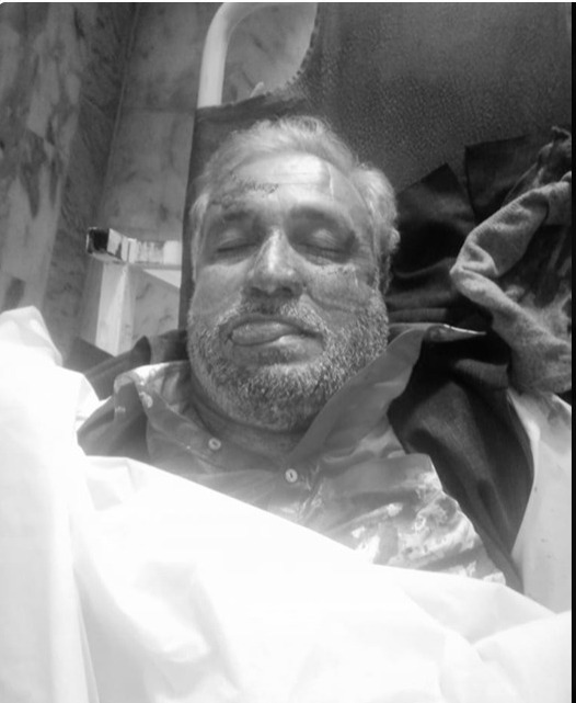 سوات: تھانہ کبل کے علاقہ ہزارہ میں نامعلوم افراد کی موٹر سائیکل پر فائرنگ،محمد سلیم ایڈوکیٹ جابحق